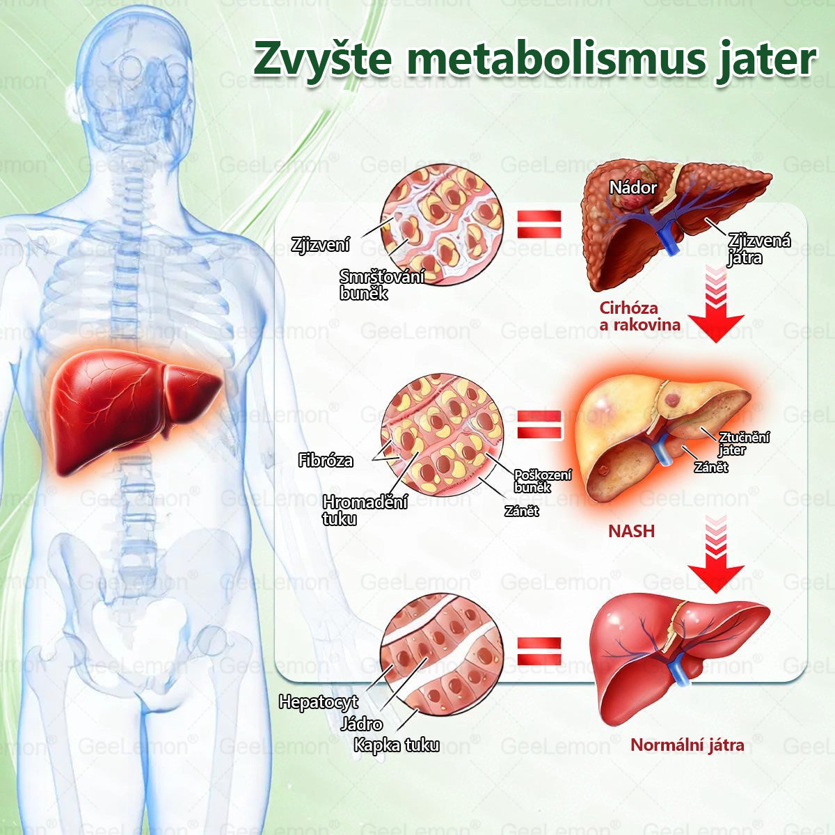 Oficiální prodejna BENU | 🎁 𝐆𝐞𝑒𝑙𝑒𝐦𝐨𝐧® Glum𝐚𝐬𝐞tide 8 v 1 – Zeštíhlující nano mikrojihlový náplast 🇨🇿 Jen 1× denně ✅ Viditelné změny za 7 dní – na obezitu, kardiovaskulární zdraví, diabetes a kloubní problémy