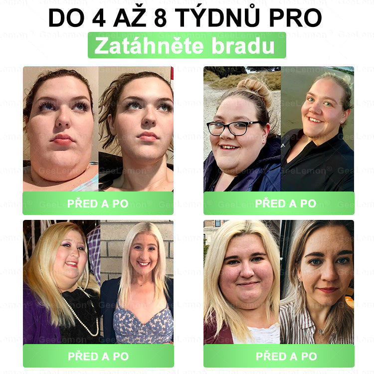 Oficiální prodejna BENU | 🎁 𝐆𝐞𝑒𝑙𝑒𝐦𝐨𝐧® Glum𝐚𝐬𝐞tide 8 v 1 – Zeštíhlující nano mikrojihlový náplast 🇨🇿 Jen 1× denně ✅ Viditelné změny za 7 dní – na obezitu, kardiovaskulární zdraví, diabetes a kloubní problémy