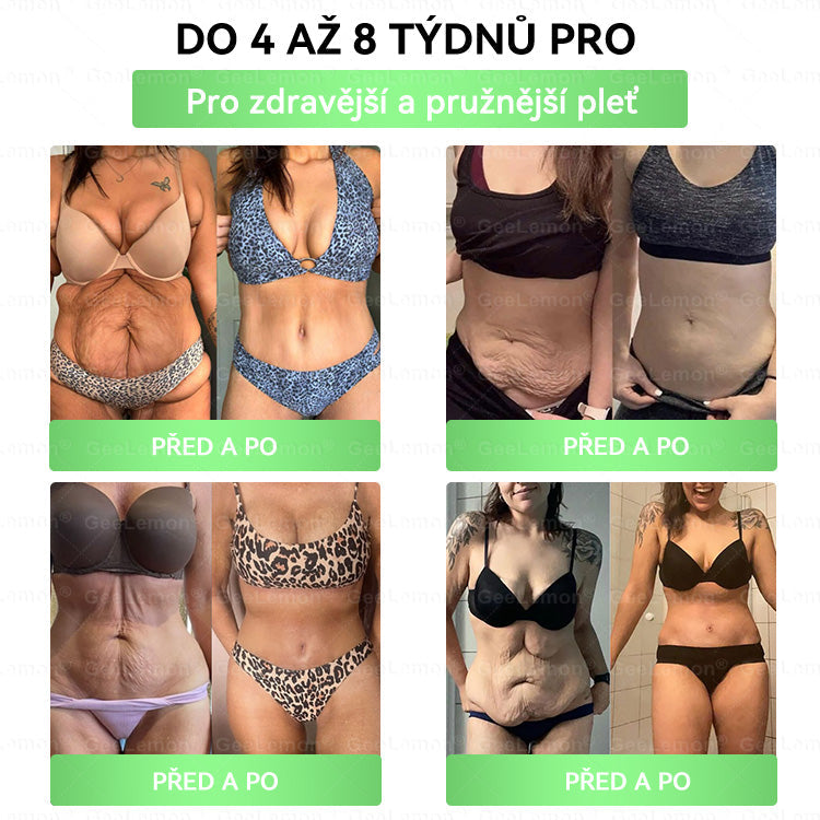 Oficiální prodejna BENU | 🎁 𝐆𝐞𝑒𝑙𝑒𝐦𝐨𝐧® Glum𝐚𝐬𝐞tide 8 v 1 – Zeštíhlující nano mikrojihlový náplast 🇨🇿 Jen 1× denně ✅ Viditelné změny za 7 dní – na obezitu, kardiovaskulární zdraví, diabetes a kloubní problémy